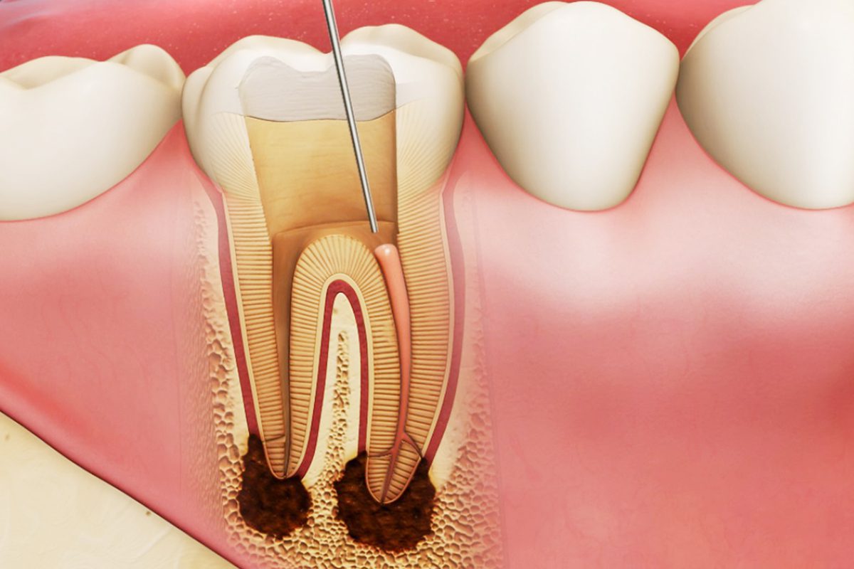 periodontist montreal