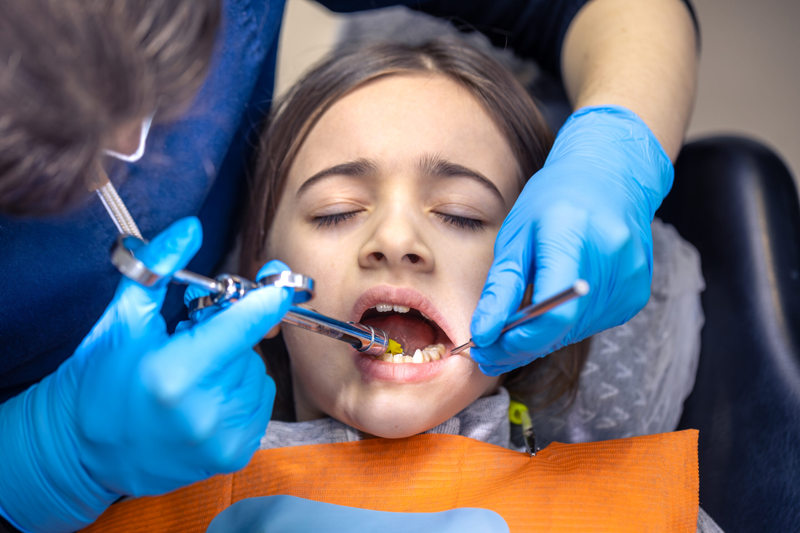 Tooth Decay Treatment